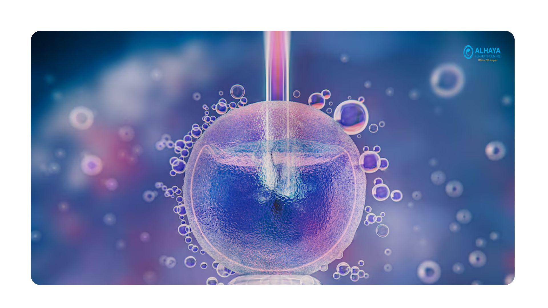 reproductive-technology-alhaya-fertility-center